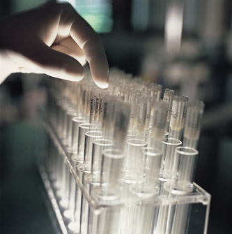 Helmholtz Forschungsgemeinschaft - Submitting mice to EMMA