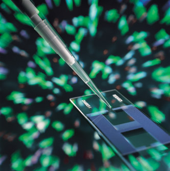 Helmholtz Forschungsgemeinschaft - Cost of EMMA services