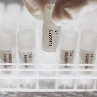 Helmholtz Forschungsgemeinschaft - Submitting mice to EMMA