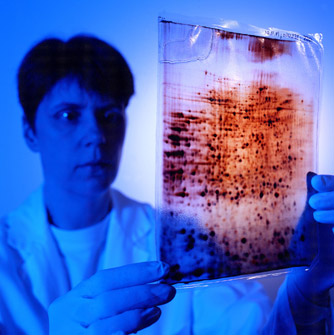 Helmholtz Forschungszentrum - DNA Gel