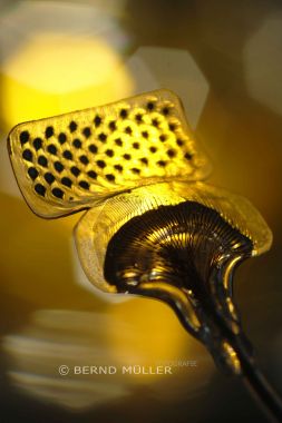 Implantierbare Elektroden-Arrays helfen bei schwerster Epilepsie Erregungsherde zu identifizieren  - IMTEK Universität Freiburg